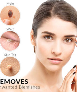 Micro Skin Tag Remover