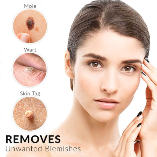 Micro Skin Tag Remover