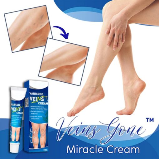 Varicose Veins Cream