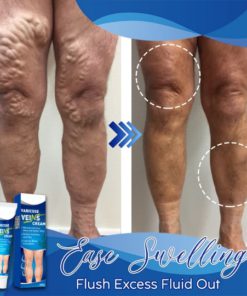 Varicose Veins Cream