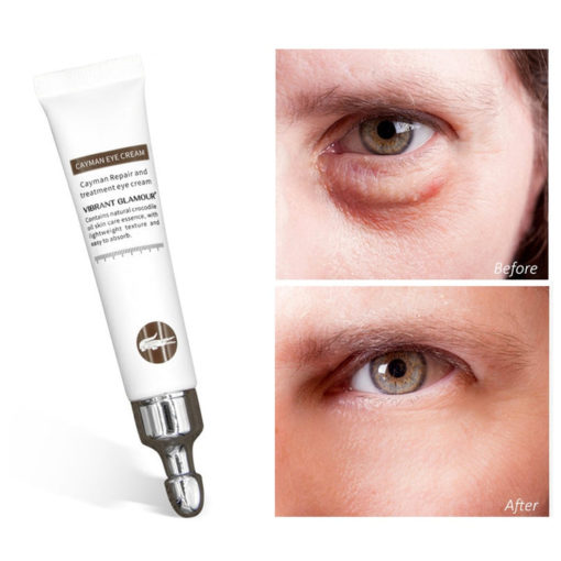 Anti Aging Eye Cream