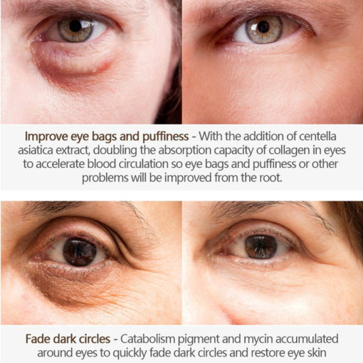 Anti Aging Eye Cream