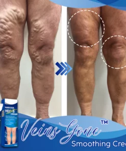 Veins Gone Smoothing Cream