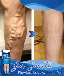 Veins Gone Smoothing Cream