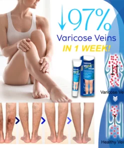 Veins Gone Smoothing Cream