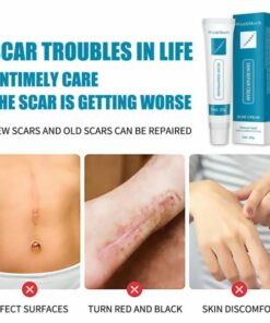 Scar & Acne Bump Removal Cream