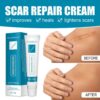 Scar & Acne Bump Removal Cream