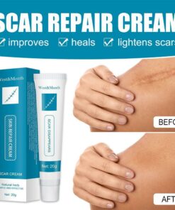 Scar & Acne Bump Removal Cream