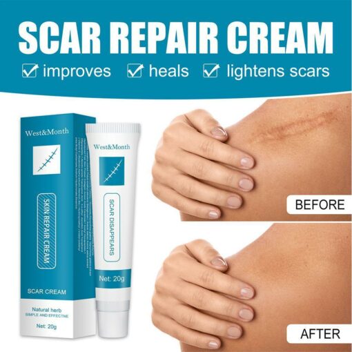 Scar & Acne Bump Removal Cream