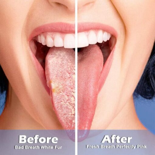 Tongue Cleaning Gel