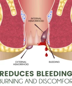 Korean Herbal Hemorrhoids Spray