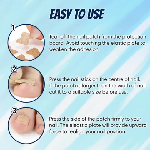 Ingrown Toenail Correction Patch