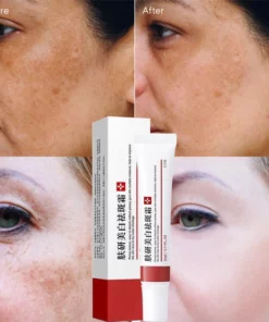 Freckle Whitening Cream