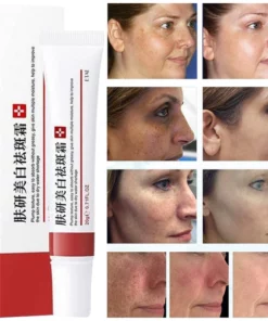 Freckle Whitening Cream