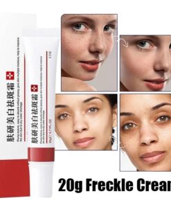 Freckle Whitening Cream