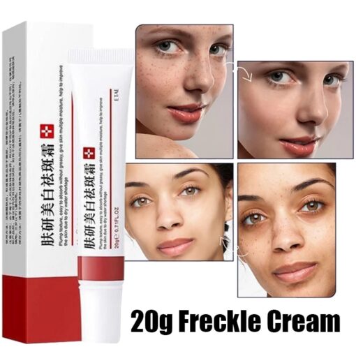 Freckle Whitening Cream