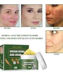 Ginseng Herbal Acne Cream