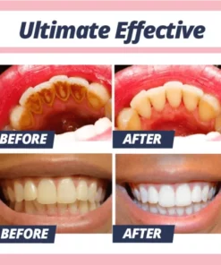 Dr. White Stain Removal Toothpaste