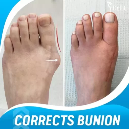 Dr.Fit Silicone Bunion Corrector