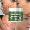 Ginseng Herbal Acne Cream