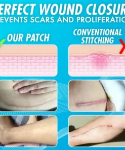 Recovery Closure Enhancing Zipped Up Bandage Patch