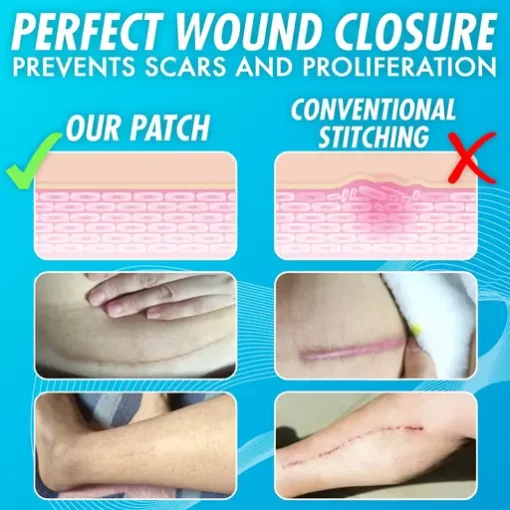 Recovery Closure Enhancing Zipped Up Bandage Patch