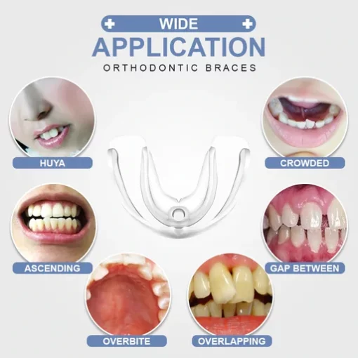 Tooth Orthodontic Braces