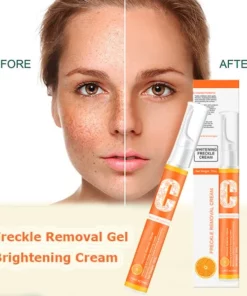 Vitamin C Freckle Dark Spot Removal Cream