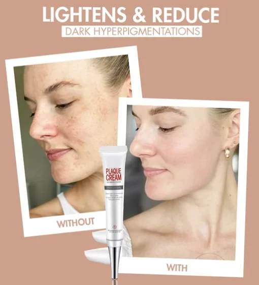 Zero Dark Wizard Whitening Freckle Cream