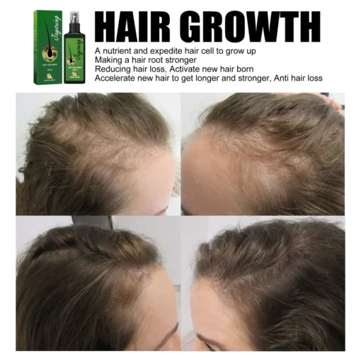 jaysuing new product nourishing anti-hair loss