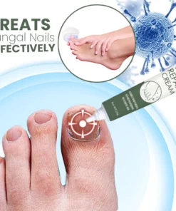 LifeMed Home Use Onychomycosis Fungal Laser Treatment