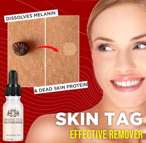 TagGone™ Natural Tags Serum