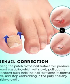 HealPatch™ Ingrown Toenail Corrector