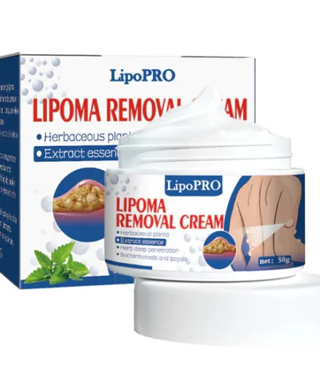 LipoPRO™ Lipoma Removal Cream（Limited Time Discount 🔥 Last Day）