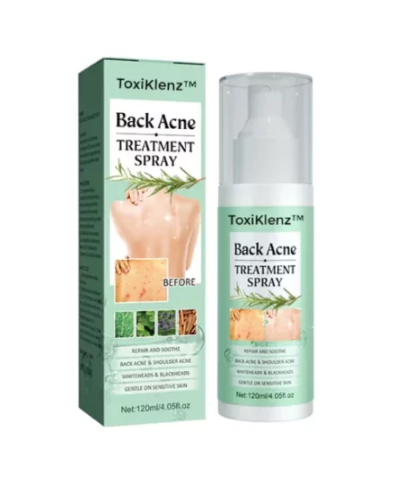 ToxiKlenz™ Back Acne Treatment Spray