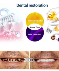 𝐃𝐎𝐂𝐓𝐈𝐀™ TeethRestoration Toothpaste Gel