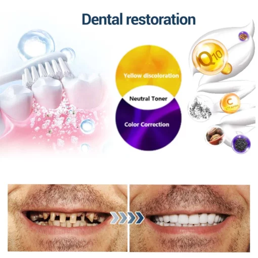 𝐃𝐎𝐂𝐓𝐈𝐀™ TeethRestoration Toothpaste Gel