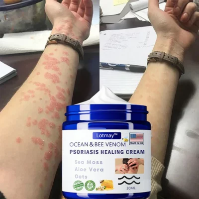 Piguiay™ Bee Venom & Ocean Psoriasis Healing Cream