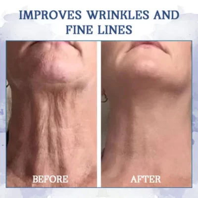 Fuzero™ Advanced Firming & Wrinkle-Reducing Cream. Fubsta™ Advanced Peptide Firming & Wrinkle-Reducing Cream . Fubsta™ Advanced Firming & Wrinkle-Reducing Cream, Fivfivgo™ Skin Lifting Wrinkle Removal Cream