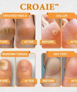 CROAIE™ Bee Venom & Herbal Slimming Foot Patches for Lymphatic Support and Blood Sugar Balance