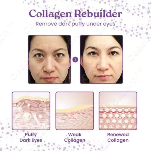 Ceoerty™ GlowEyes Collagen Eye Cream