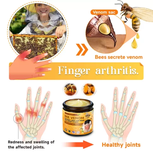 Croaie™ Bee Venom & Turmeric Joint and Bone Pain Relief Cream