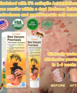 Cvreoz™ Bee Venom Psoriasis Treatment Ointment