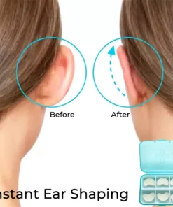 Fivfivgo™ Cosmetic Ear Corrector