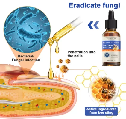 Furzero™ Bee Venom Nail Folliculitis Treatment Program