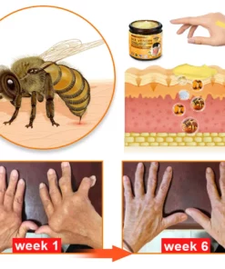 Furzero™ Bee Venom & Turmeric Joint and Bone Pain Relief Spray