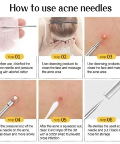 11Pcs Blackhead Needle