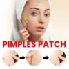 Repair Acne Patch