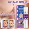 EELHOE™ Warts and Moles Herbal Removal Pen