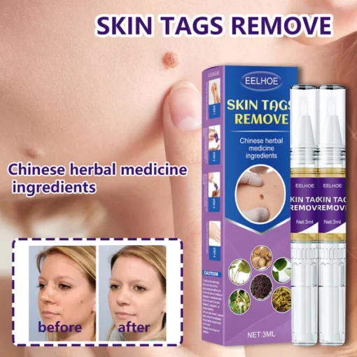 EELHOE™ Warts and Moles Herbal Removal Pen